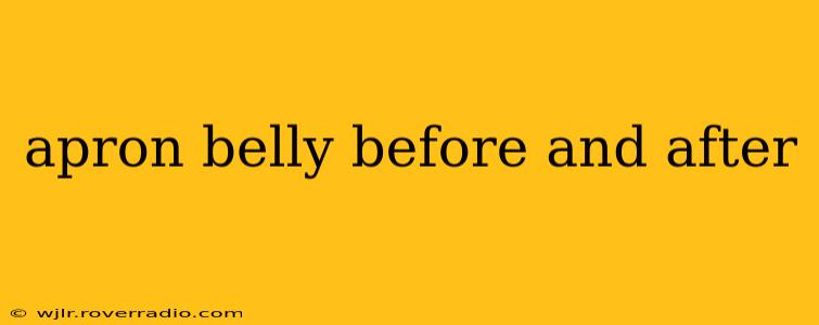 apron belly before and after
