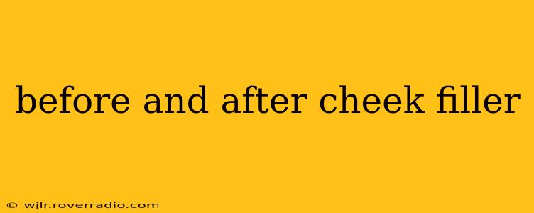 before and after cheek filler