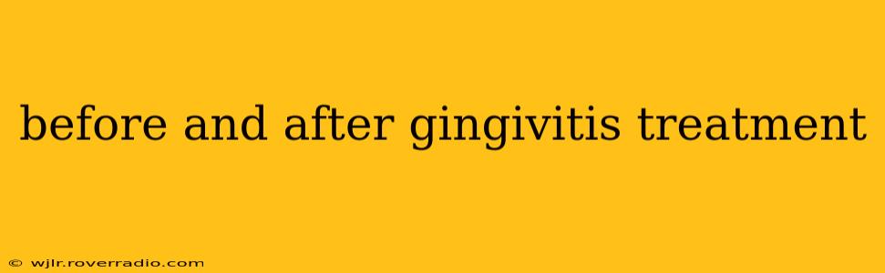before and after gingivitis treatment