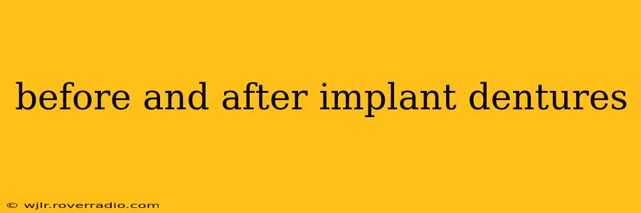 before and after implant dentures