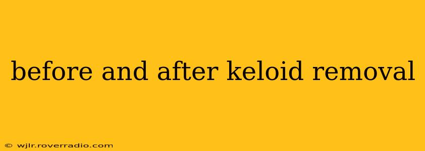before and after keloid removal