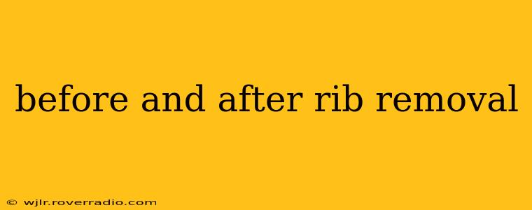 before and after rib removal