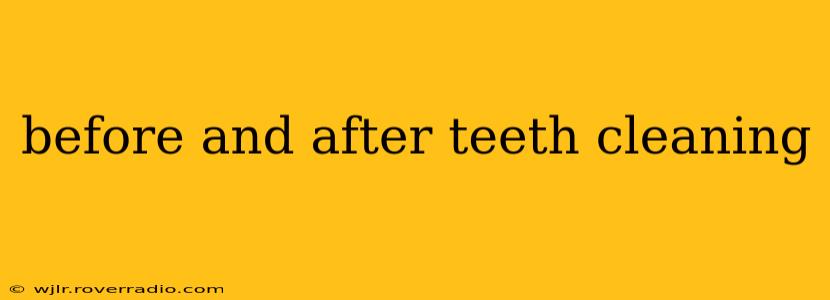 before and after teeth cleaning