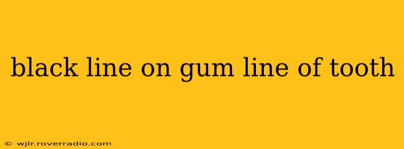 black line on gum line of tooth