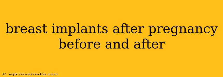 breast implants after pregnancy before and after