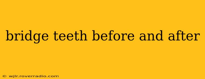 bridge teeth before and after