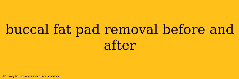 buccal fat pad removal before and after