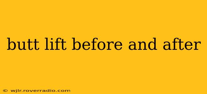 butt lift before and after