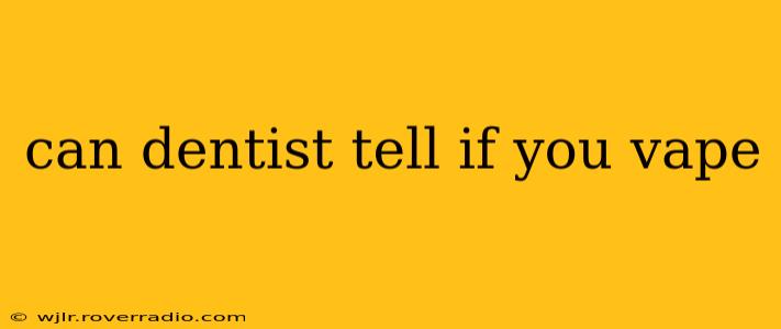 can dentist tell if you vape