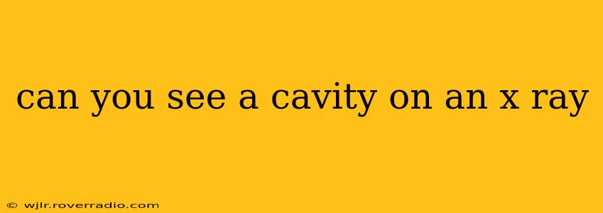 can you see a cavity on an x ray