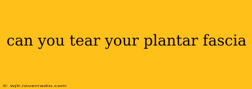 can you tear your plantar fascia
