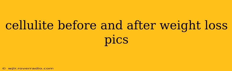 cellulite before and after weight loss pics