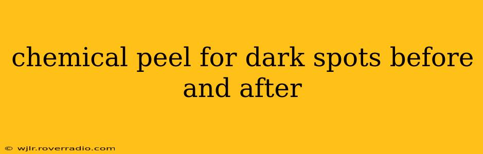 chemical peel for dark spots before and after