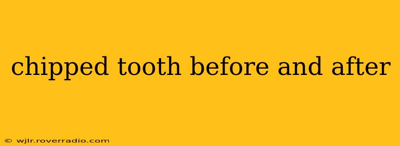 chipped tooth before and after