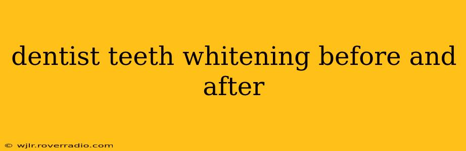 dentist teeth whitening before and after