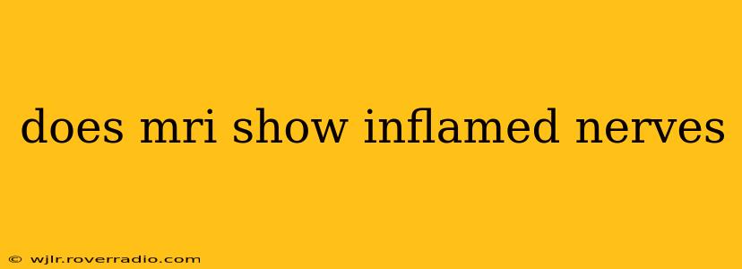 does mri show inflamed nerves