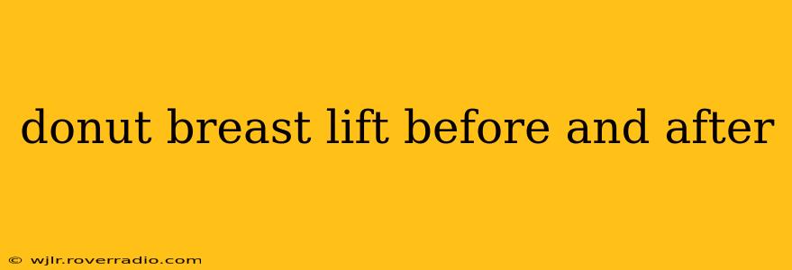 donut breast lift before and after