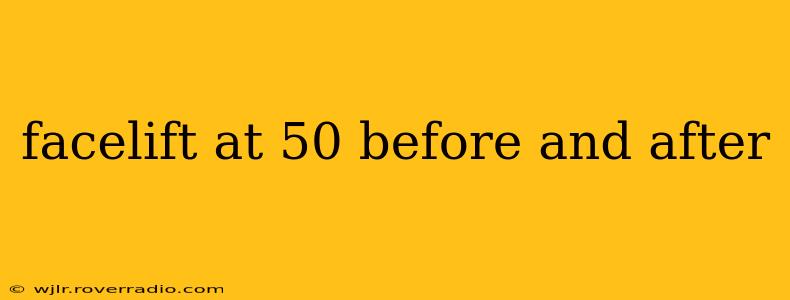 facelift at 50 before and after