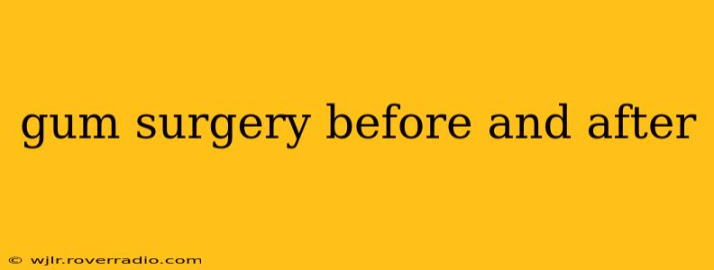 gum surgery before and after