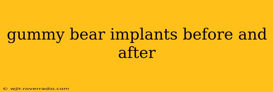 gummy bear implants before and after