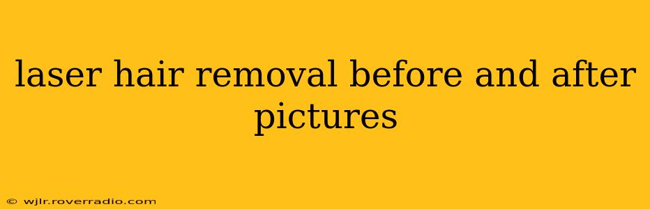 laser hair removal before and after pictures