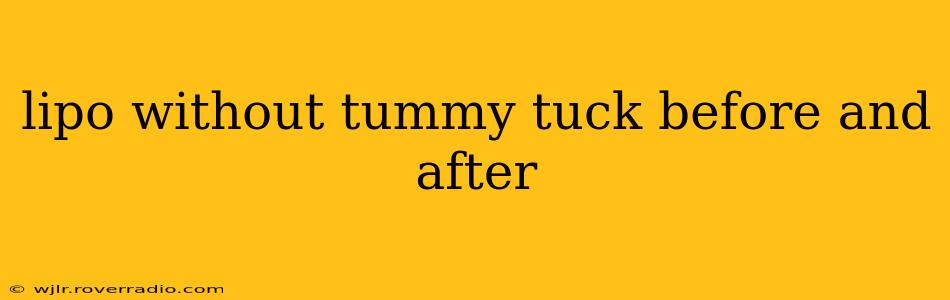 lipo without tummy tuck before and after