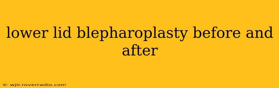 lower lid blepharoplasty before and after