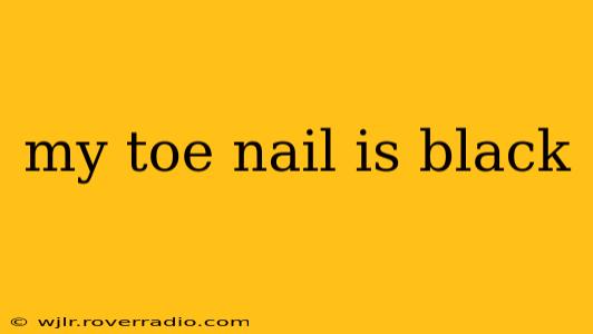 my toe nail is black