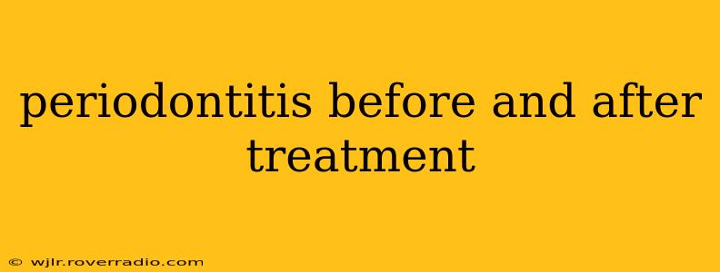 periodontitis before and after treatment