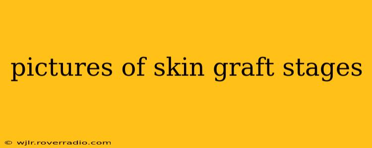 pictures of skin graft stages