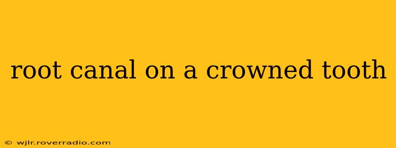 root canal on a crowned tooth