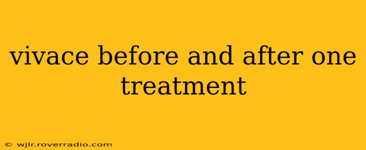 vivace before and after one treatment