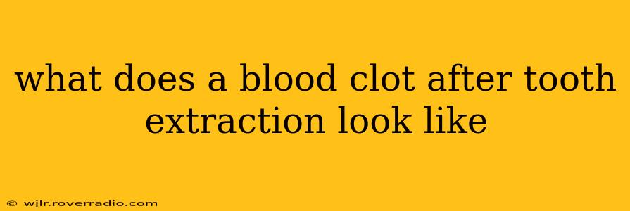 what does a blood clot after tooth extraction look like