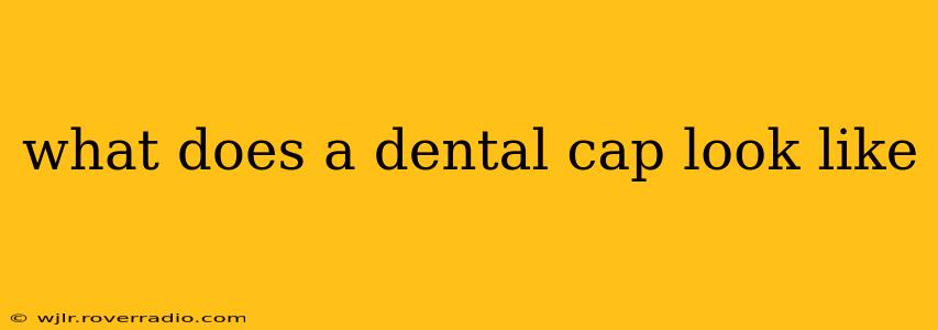 what does a dental cap look like