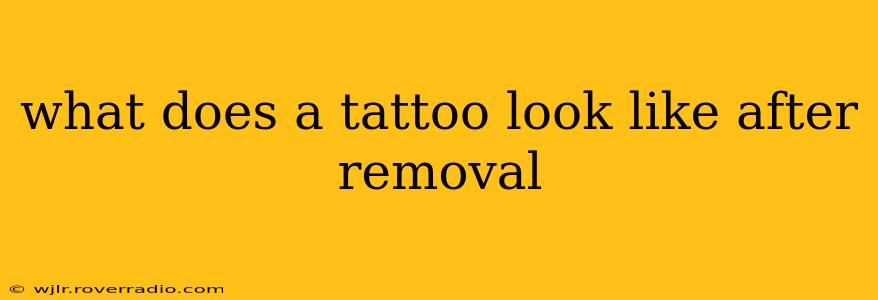 what does a tattoo look like after removal
