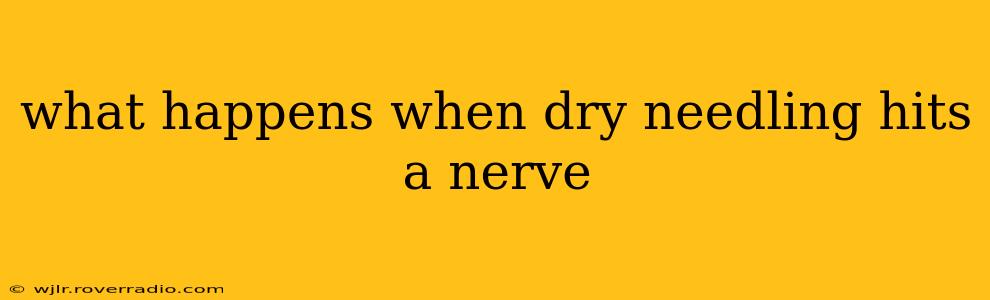 what happens when dry needling hits a nerve