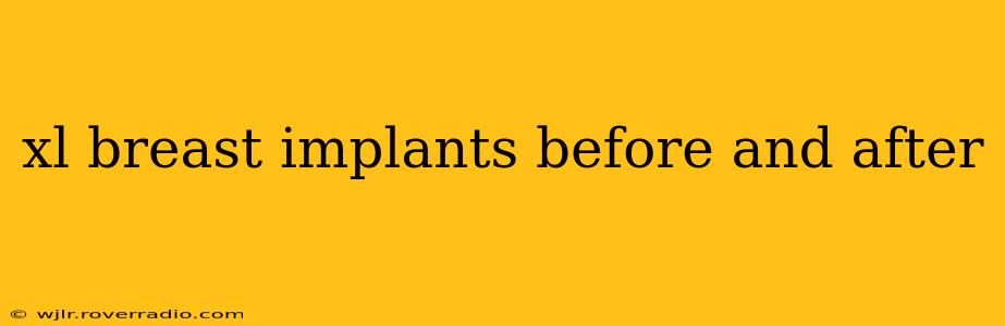 xl breast implants before and after