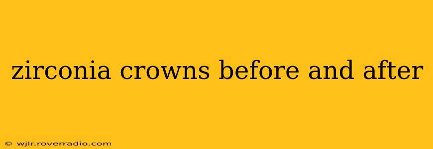 zirconia crowns before and after